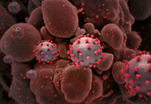 Tampilan kreatif partikel SARS-CoV-2 (tidak berskala). Kredit: Institut Nasional Alergi dan Penyakit Menular, NIH